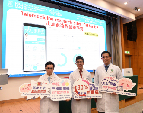 HKUMed has developed the ‘TRICH score’, an innovative clinical tool to help physicians effectively identify intracerebral hemorrhage patients who may benefit from early triple anti-hypertensive treatment. Pictured from right: Dr Teo Kay-cheong, Dr Gary Lau Kui-kai and Adrian So Ching-hei.